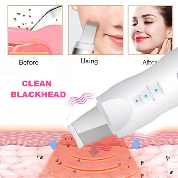 Ultrazvukové Pokožky Práčky Hlboké Tvár Čistiaci Stroj Blackhead odstránenie Odumretej Lopatu Tváre Pórov Cleaner Face Lifting Peeling