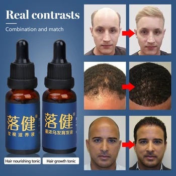 Rast vlasov Podstate Proti vypadávaniu Vlasov Rýchly Rast Vlasov Hrubé Vlasy, Opraví Vlasy Root a Pokožku hlavy a Vlasy Starostlivosť Živín Riešenie