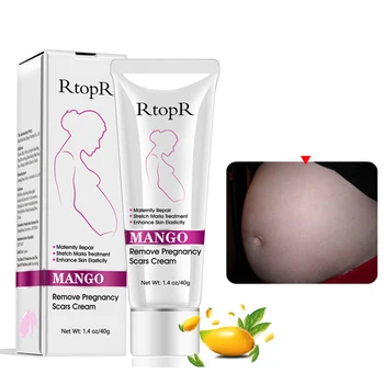 RtopR 40ml Mango strie Remover Cream Materskej Opravy Liečba Anti Winkle Pevnej Kože & Eliminovať Tehotenstva Jazvy